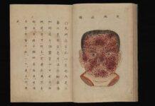 A Devastadora Epidemia de Varíola no Japão